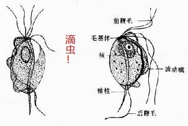 滴虫性阴道炎